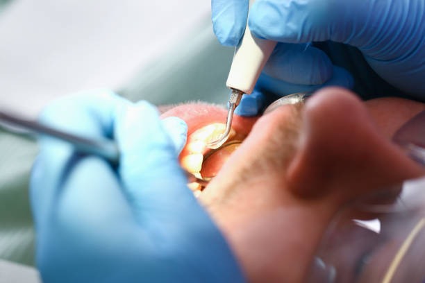 Best Emergency Dental Care for Broken or Chipped Teeth in Harrington Park, NJ